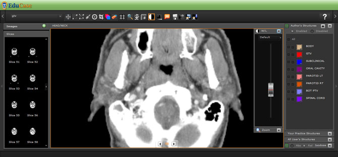 EduCase, Features, Contouring Tools, Window Leveling Tool for DICOM images