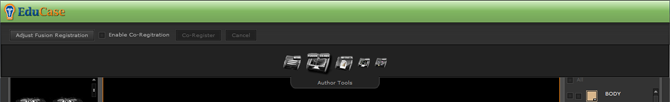 EduCase Features Author Tools Header