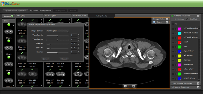 EduCase Features Author Tools Adjustment Fusion Registration and Co-Registration