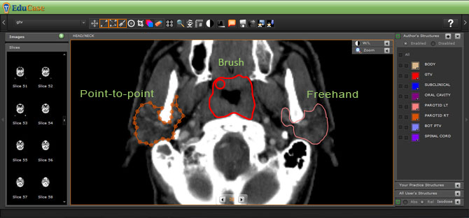 EduCase, Features, Contouring Tools, Drawing Tools for DICOM images