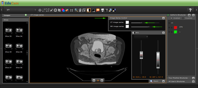 EduCase, Features, Contouring Tools, Image Series Controls for DICOM images