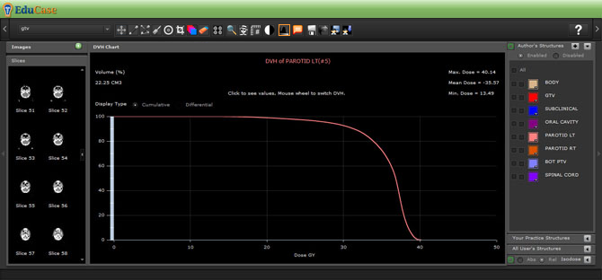 EduCase, Features, Contouring Tools, DVH Charting Tools for DICOM contours