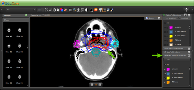 EduCase, Features, Load and Export Contours, Load saved contours