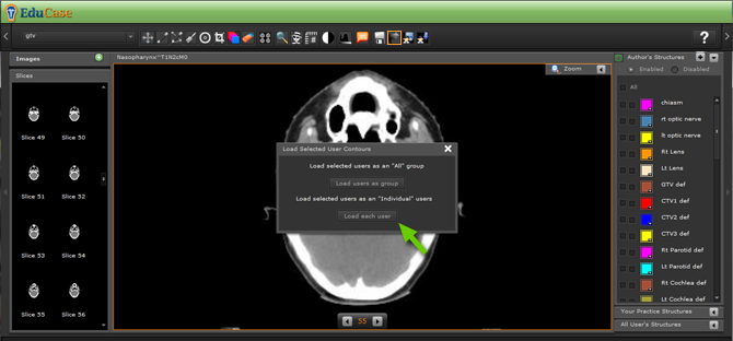 EduCase, Features, Load and Export Contours, Load saved contours