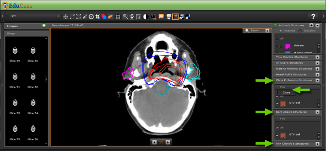 EduCase, Features, Load and Export Contours, Load saved contours