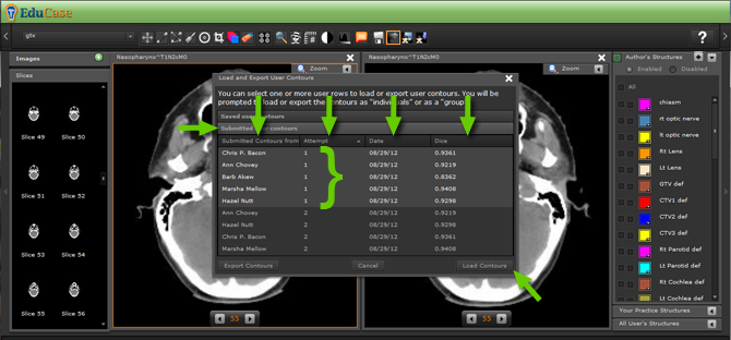 EduCase, Features, Load and Export Contours, Load saved contours