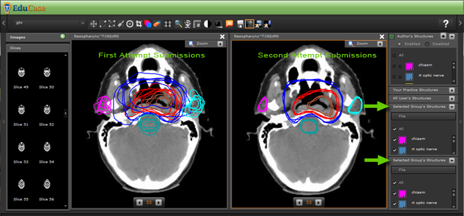 EduCase, Features, Load and Export Contours, Load saved contours