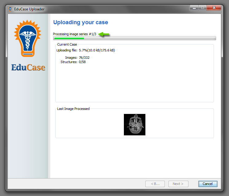 EduCase Features Uploader Tool Uploading DICOM data