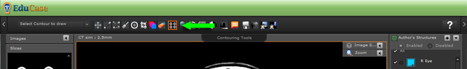 EduCase, ContouringTools, ViewTools, Header DICOM View
