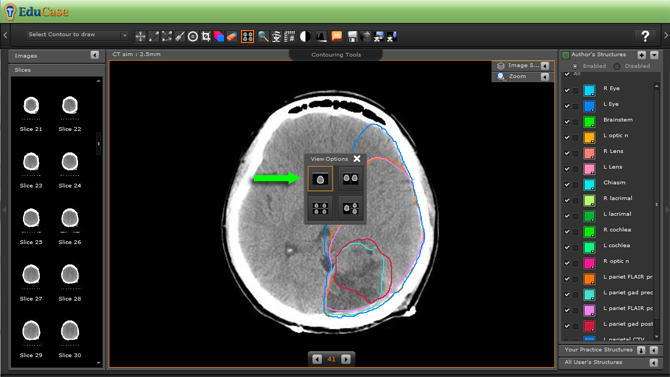 EduCase, ContouringTools, ViewTools, 1 Window DICOM View