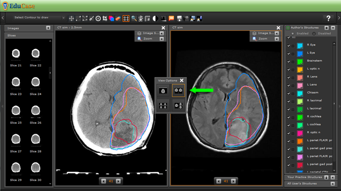 EduCase, ContouringTools, ViewTools, 2 Window DICOM View