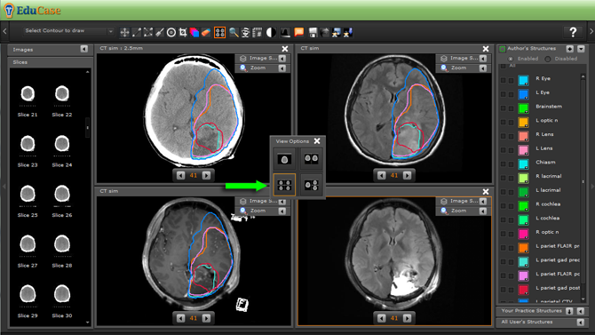 EduCase, ContouringTools, ViewTools, 4 Window DICOM View