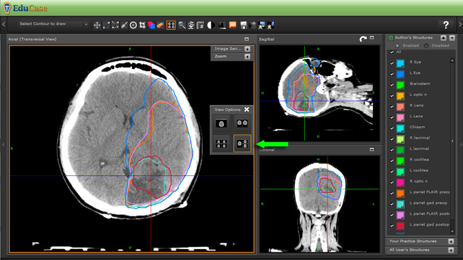 EduCase, ContouringTools, ViewTools, Orthoganal Window DICOM View